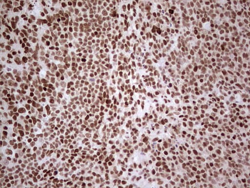 NR3C1/Glucocorticoid Receptor Antibody (aa1-265, clone OTI6A12)