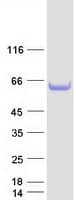 Human SMAP1 Protein (Recombinant Myc-DDK (Flag))