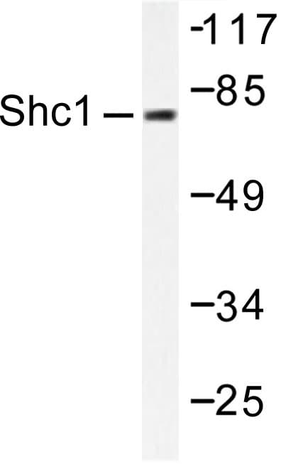 Polyclonal Rabbit anti-Human p66 / SHC Antibody (Leu421, IHC, WB)