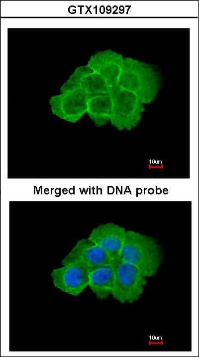 MAP4K5 Antibody (aa417-482)