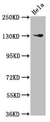 NOMO1 / PM5 Antibody