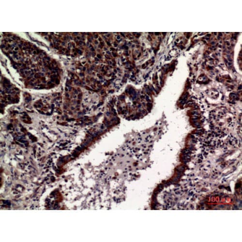Polyclonal Rabbit anti-Human CD63 Antibody (121-170 aa, Internal, IHC, WB)