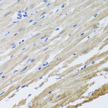 Polyclonal Rabbit anti-Human SET / TAF-I Antibody (IHC, WB)
