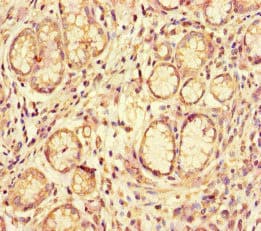 ACE2 / ACE-2 Antibody