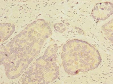 THTPA Antibody