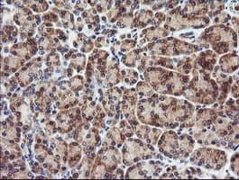 Monoclonal Mouse anti-Human CTAG1B / NY-ESO-1 Antibody (clone OTI5H4, IHC, IF, WB)