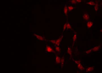 STAT5A Antibody (phospho-Ser780)