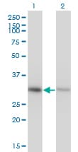 IHC-plus™ Monoclonal Mouse anti-Human ANXA4 / Annexin IV Antibody (clone 1D3, IHC, WB)