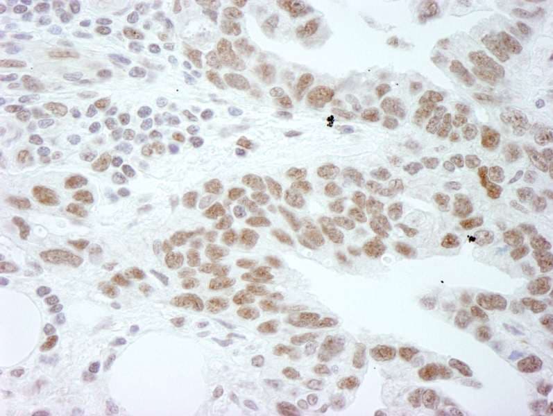 Polyclonal Rabbit anti-Human DDX1 Antibody (aa500-550, IHC)