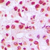 Polyclonal Rabbit anti-Human REL / C-Rel Antibody (C-Terminus, IHC, WB)