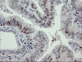 Monoclonal Mouse anti-Human MAFB Antibody (clone OTI2A6, IHC, WB)