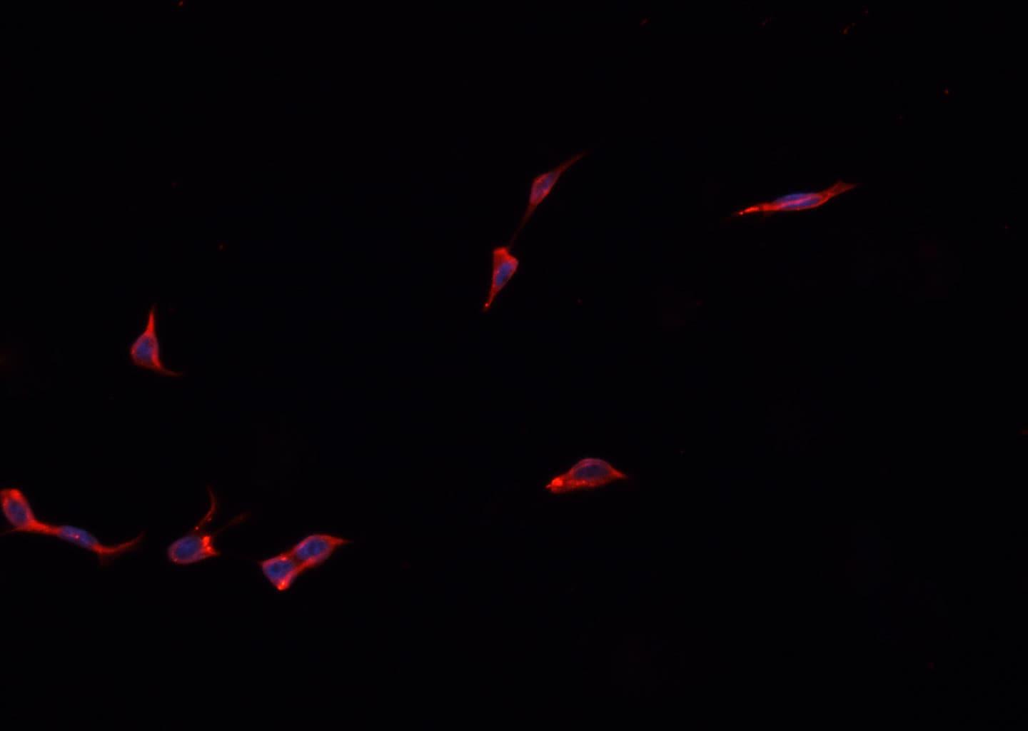 KCNMB1 Antibody