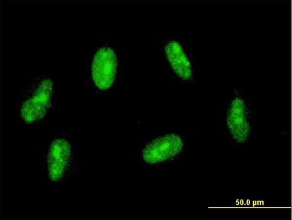 SAP30 Antibody (clone 4D2)