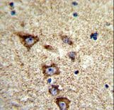Polyclonal Rabbit anti-Human KCNH7 / ERG3 Antibody (aa52-78, IHC, WB)