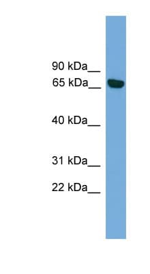 PRKCI / PKC Iota Antibody (aa215-264)