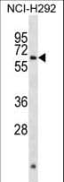 ARX Antibody (aa40-69)