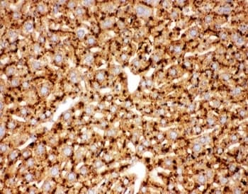 CTSD / Cathepsin D Antibody (aa65-410)