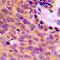 MMP9 / Gelatinase B Antibody (C-Terminus)