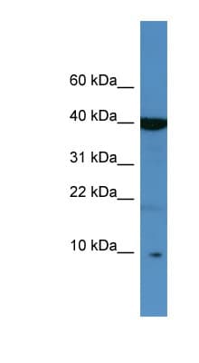 Polyclonal Rabbit anti-Human SPINK6 Antibody (C-Terminus, WB)