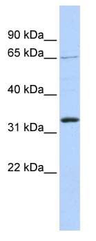 GRHL2 Antibody (C-Terminus)