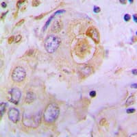Polyclonal Rabbit anti-Human SPP1 / Osteopontin Antibody (C-Terminus, IHC, WB)