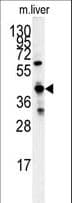 GCAT Antibody (aa155-181)