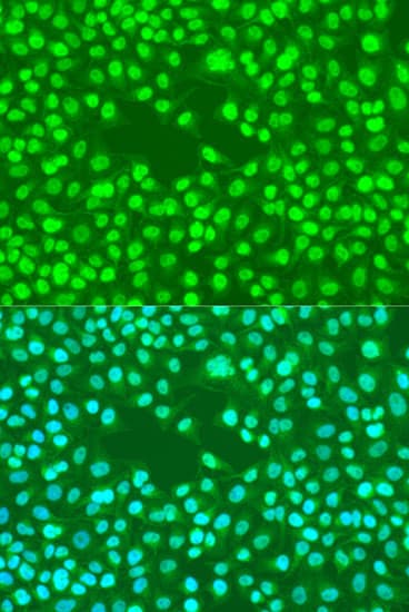 RAD23B / HR23B Antibody
