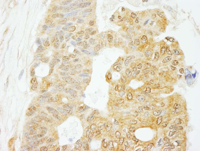 EIF4G1 / EIF4G Antibody (aa250-300)