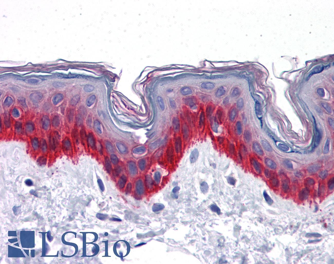 IHC-plus™ KRT81 / Keratin 81 / KRTHB1 Antibody (clone 3B10-5B10)