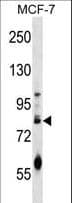 ACRC Antibody (aa599-628)