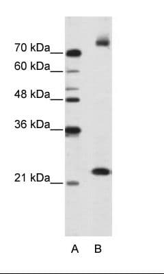 FZD9 / Frizzled 9 Antibody (aa181-230)