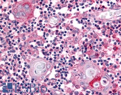IHC-plus™ USP4 Antibody (Internal)
