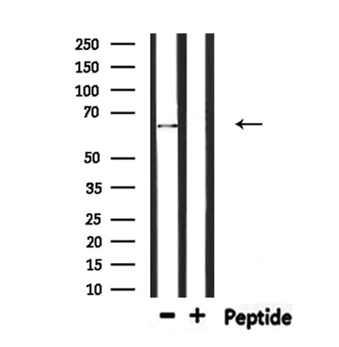 Polyclonal Rabbit anti-Human AICAR / ATIC Antibody (IHC, WB)
