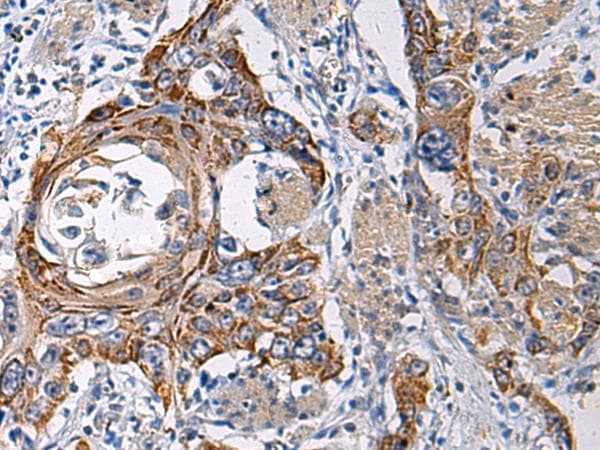 Polyclonal Rabbit anti-Human RITA1 / C12orf52 Antibody (IHC)