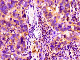 CFI / Complement Factor I Antibody