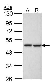 IHC-plus™ KRR1 Antibody (aa47-344)
