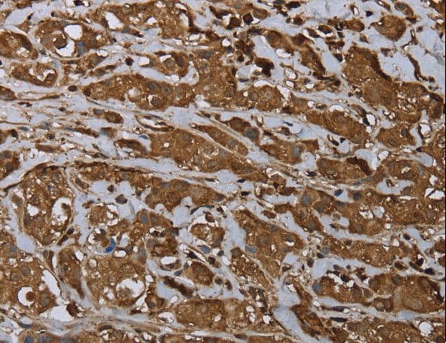 ARHGDIA / RHOGDI Antibody