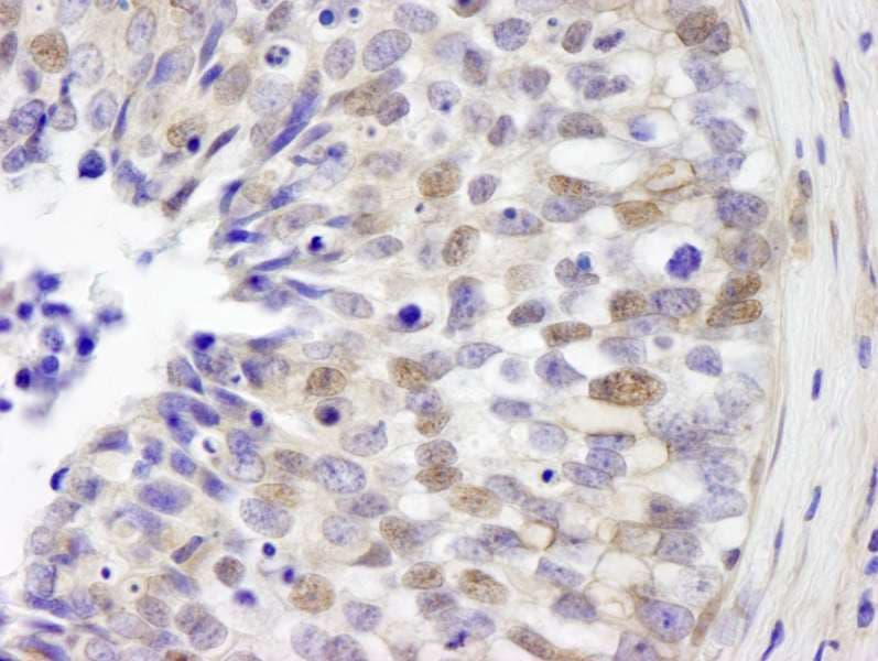 IRF3 Antibody (aa100-150)