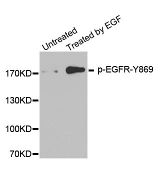EGFR Antibody (phospho-Tyr869)