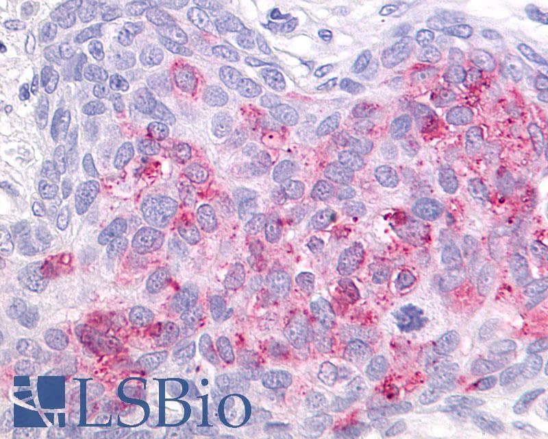 PathPlus™ GPR55 Antibody (C-Terminus)