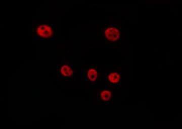 CCND2 / Cyclin D2 Antibody (phospho-Thr280)