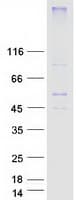 Human SLC2A8 / GLUT8 Protein (Recombinant Myc-DDK (Flag))