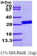 E. coli udp Protein (Recombinant His)