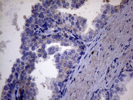 AKIP1 / BCA3 Antibody (clone OTI2E4)