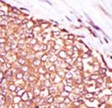 Polyclonal Rabbit anti-Human PRKCQ / PKC-Theta Antibody (aa318-348, IHC, WB)