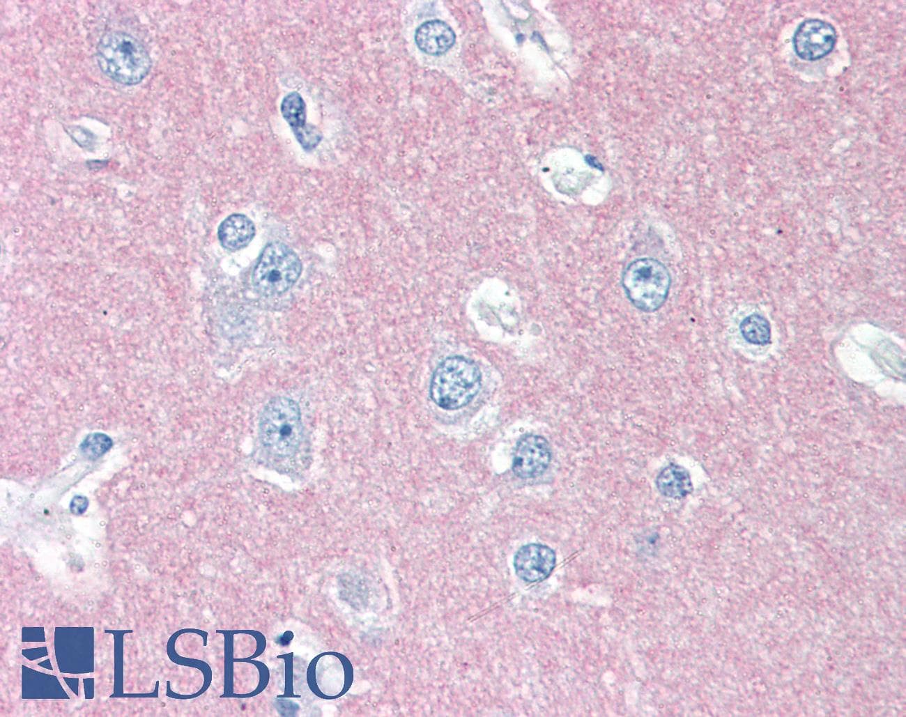 PathPlus™ Monoclonal Mouse anti-Human THY1 / CD90 Antibody (clone 5E10, IHC)