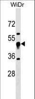 UQCRC1 Antibody (aa141-170)