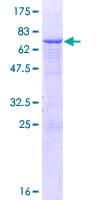 Human SMPDL3A Protein (Recombinant GST)