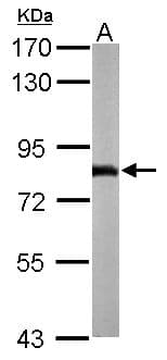 NDUFS1 Antibody (aa432-664)
