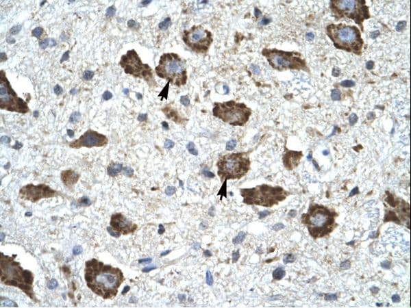 Polyclonal Rabbit anti-Human KCNIP2 / KCHIP2 Antibody (aa22-71, IHC, WB)